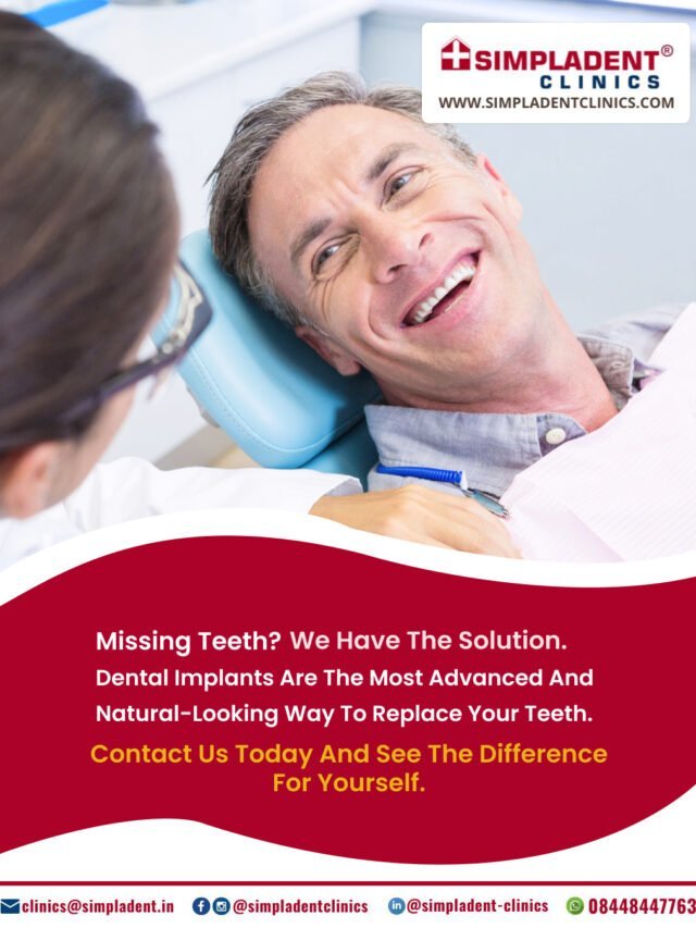 Discover the Longevity of Dental Implants