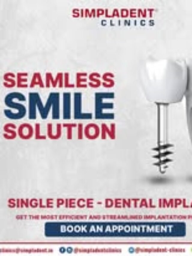 Seamless Dental Implant