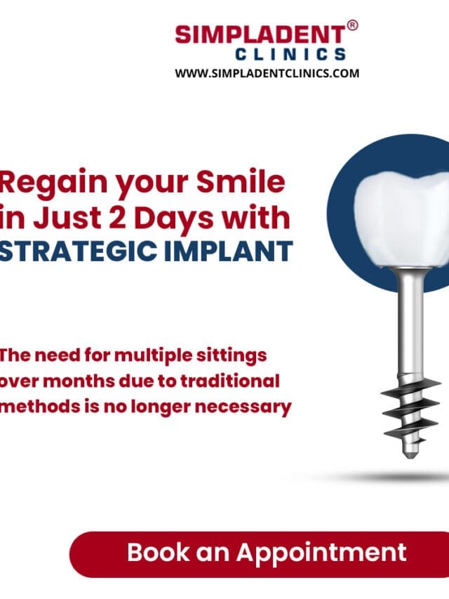 Transform Your Smile with Strategic Implants® and Flapless Implant Surgery