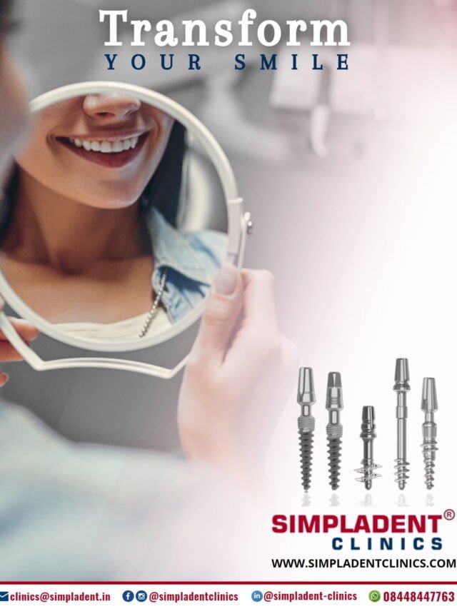 Achieve a Bright, Perfect Smile with Dental Implants