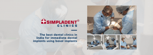 Simpladent Clinics - Single piece implants with Retrievability | Basal Implants | #1 Dental Clinic