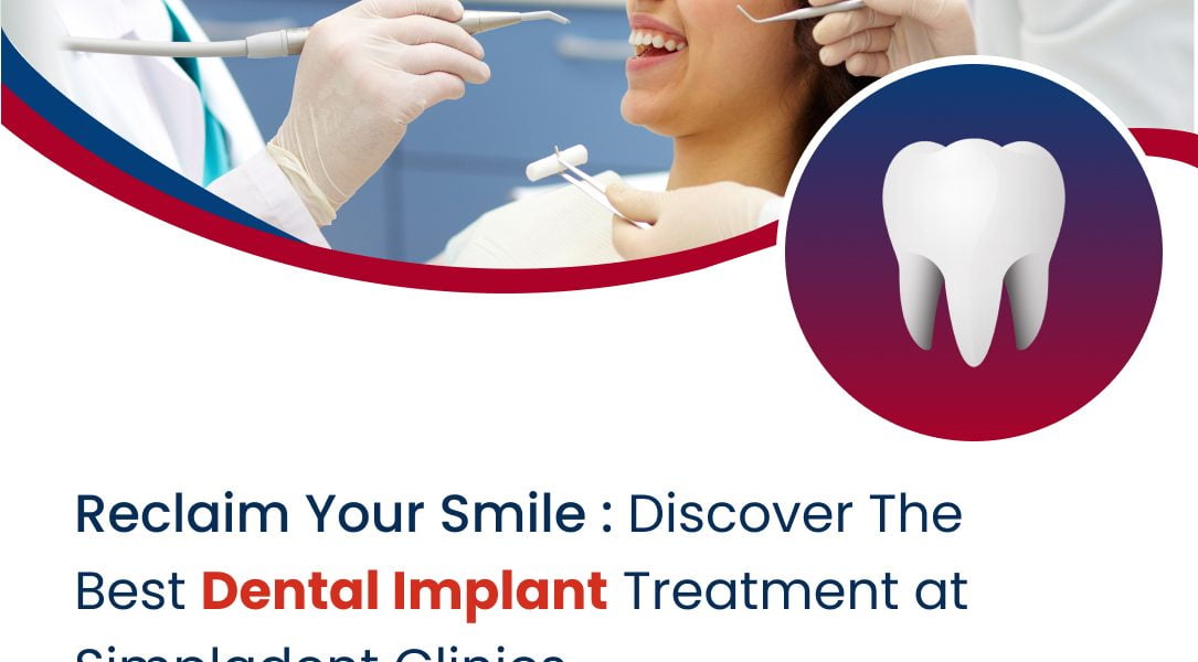 Full-Mouth Dental Implants