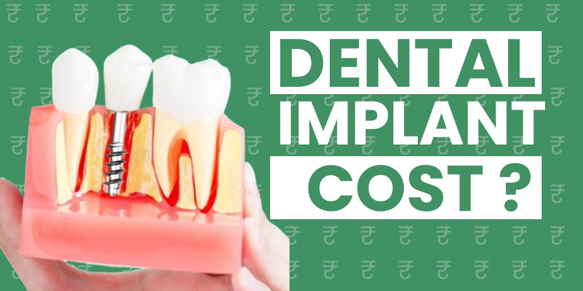 Affordable dental implants procedure, advanced dental technology, cost-effective dental restoration, expert implant dentist, long-lasting dental solution.