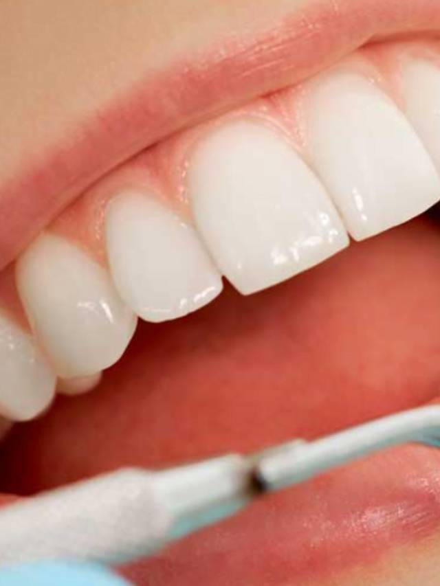 Revolutionize Your Smile with Strategic Implants